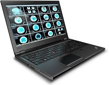 Amazon.com: Lenovo 15.6