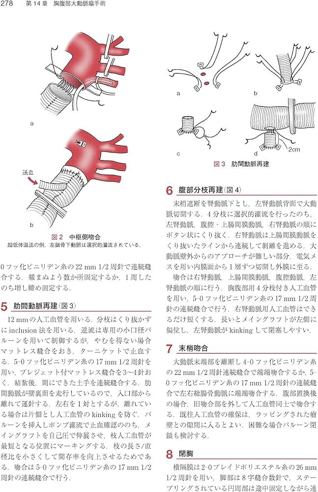 心臓・大動脈外科手術: 基本・コツ・勘所 | 小坂 眞一 |本 | 通販 | Amazon